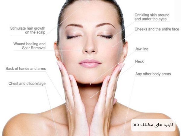 کاربرد های مختلف پی آر پی که کنار تصويری از صورت يک خانم با پس زمينه سفيد نوشته شده است.