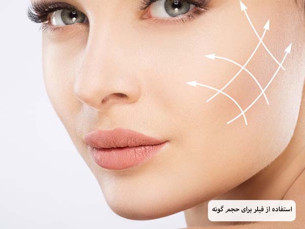 خط های سفید روی صورت یک خانم که نشان دهنده محل تزریق فیلر هستند در پس زمینه سفید.