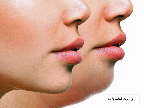نمای نیم رخ یک خانم که بعد از مزوتراپی چربی غبغب وی کامل از بین رفته است