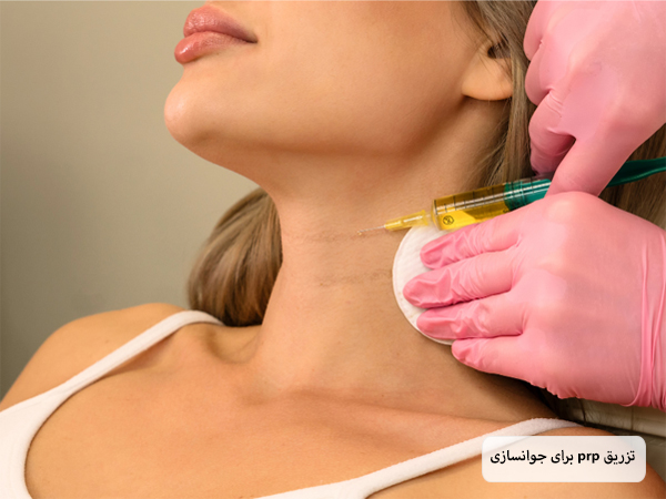 تزریق محلول پی آر پی به اطراف گردن یک خانم توسط متخصص.