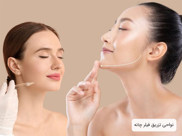 نشان دادن تزريق فيلر چانه و نواحي تزريق آن روي صورت دو خانم به طور مجزا با پس زمينه خاکي رنگ