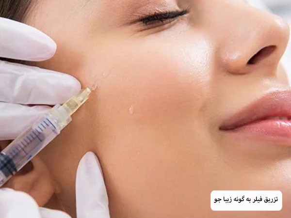 تزریق فیلر گونه به صورت یک خانم جوان تئوسط متخصص