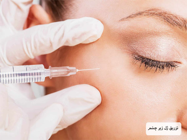 تزریق فیلر به زیر چشم یک خانم توسط پزشک.