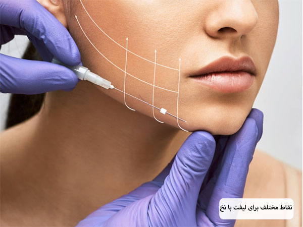پزشکی در حال استفاده از نخ لیفت روی صورت یک خانم در پس زمینه سفید.