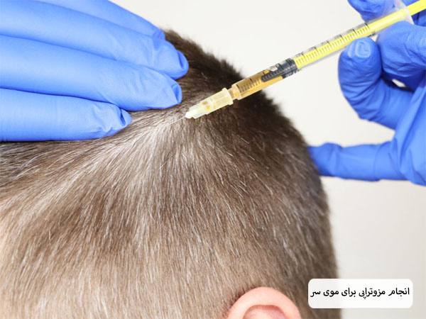 تزریق کوکتل مو به سر یک آفای جوان با مو های بور و کم پشت توسط متخصص.