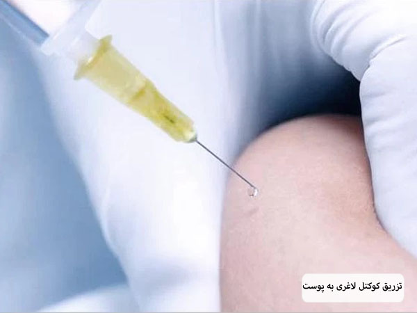 تزریق کوکتل لاغری به پوست زیبا جو توسط متخصص.