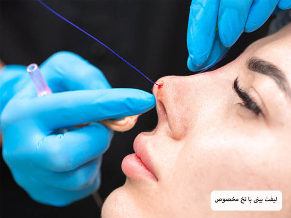 لیفت بینی یک خانم زیبا جو توسط پزشک متخصص.