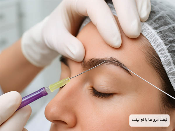 لیفت ابرو های یک خانم با نخ مخصوص توسط پزشک متخصص در کلینیک.