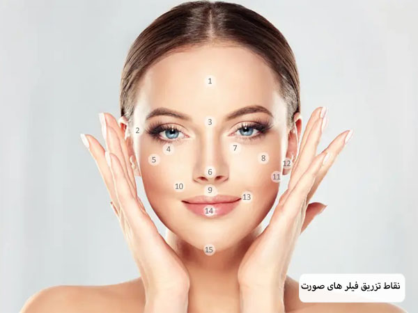 نقاط مخصوص تزریق فیلر زیر چشم روی صورت یک خانم جوان نمایش داده شده است.