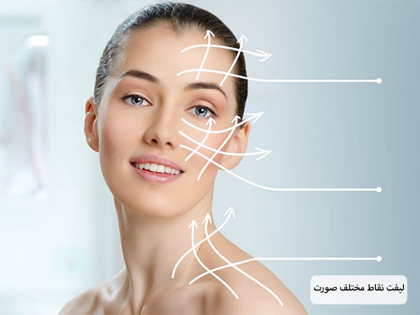 نقاط مختلف برای لیفت با نخ روی صورت یک خانم جوان نمایش داده شده است.