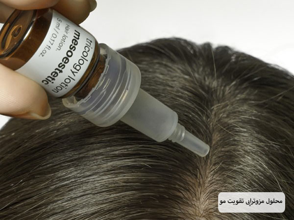 پزشک متخصص در حال ریختن محلول کوکتل مزوتراپی روی مو های سر زیبا جو است.