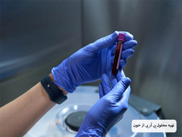 نمونه خون بیمار در دست پزشک با دستکش آبی رنگ.