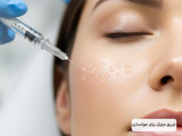 تزریق مزوژل به صورت یک خانم جوان برای جوانسازی و زیبایی پوست.