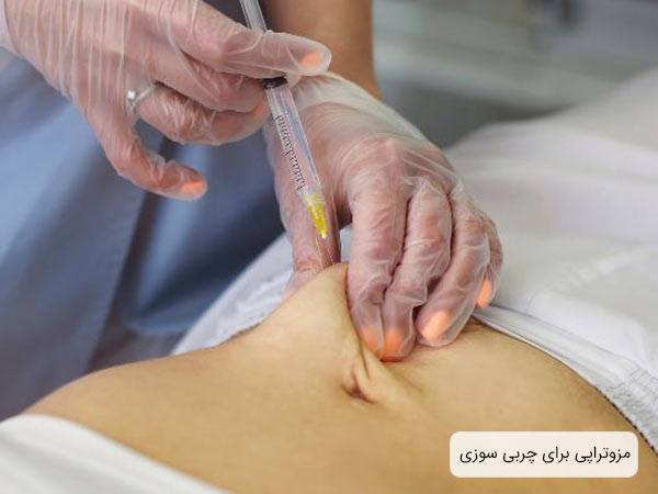 تزريق مزو چربي سوز به شکم زيبا جو توسط متخصص در کلينيک.