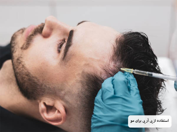 پزشکی در حال تزریق محلول پی آر پی به موی سر یک مرد جوان.