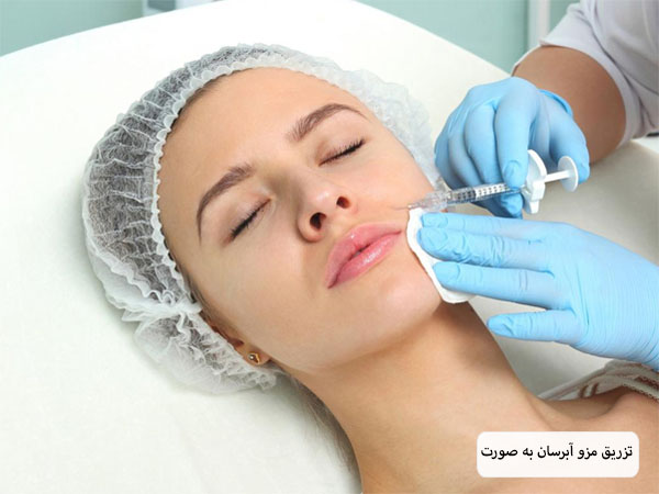 تزریق کوکتل آبرسان به خط خنده یک خانم جوان توسط پزشک متخصص.