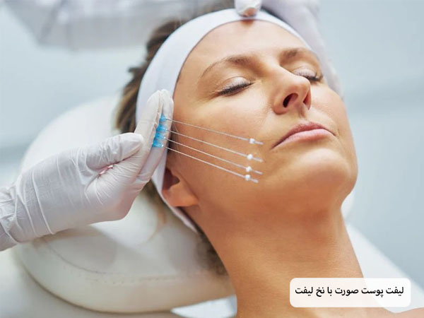 چند عدد نخ لیفت که در کنار صورت یک خانم زیبا جو قرار گرفته اند.