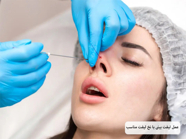 انجام عمل لیفت بینی با نخ توسط متخصص روی بینی یک خانم زیباجوی جوان.