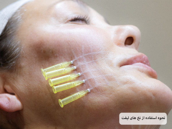 چند عدد نخ لیفت که روی صورت یک خانم مسن قرار داده شده اند.