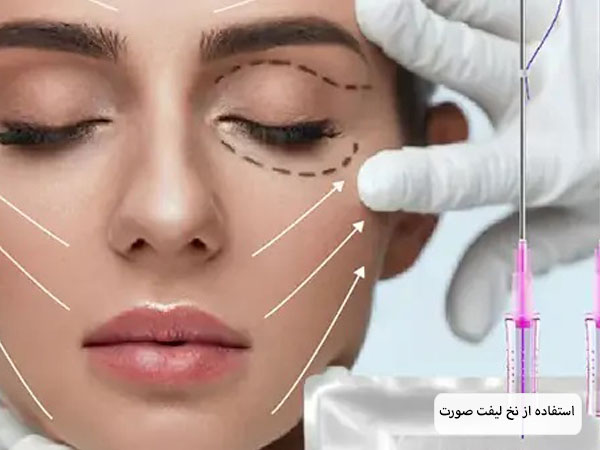 قسمت های مختلف صورت یک خانم جوان که با نخ لیفت برای جوانسازی نشانه گذاری شده است از نمای نیم رخ در پس زمینه یاسی رنگ.