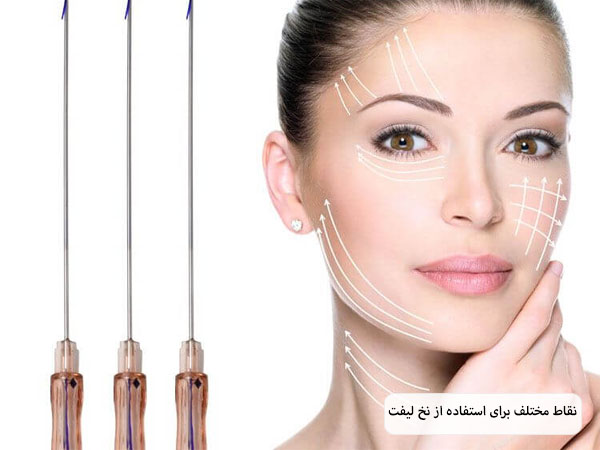 سه عدد نخ لیفت که در کنار صورت یک خانم نگه داشته شده اند.