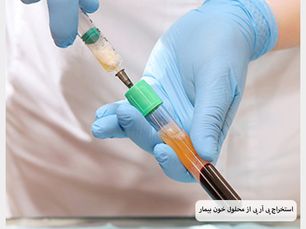 پزشکی در حال خارج کردن پی آر پی به کمک یک سرنگ از محلول خون است.