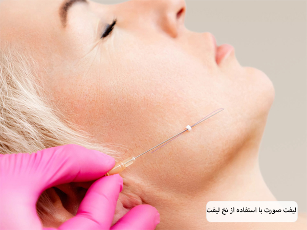 پزشکی در حال لیفت صورت یک زیباجوی جوان با نخ لیفت.