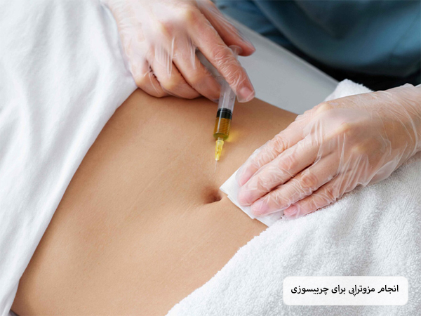 تزریق مزو چربیسوز به شکم یک خانم توسط پزشک.