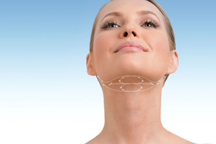 نقاط مخصوص لیفت غبغب با نخ که با خطوط فرضی روی ناحیه غبغب یک خانم نمایش داده شده اند با پس زمینه آبی سفید.