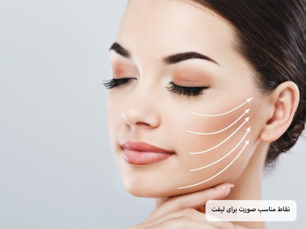 مشخص کردن نقاط مخصوص لیفت با خطوط سفید رنگ روی گونه یک خانم با پس زمینه نقره ای رنگ.