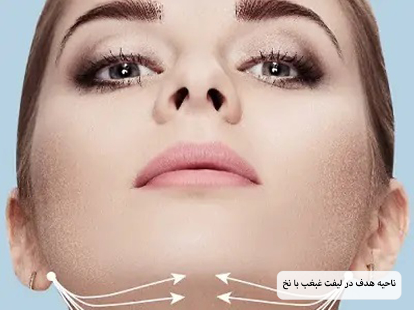 نقاط مخصوص لیفت با نخ برای غبغب روی صورت یک خانم جوان با خطوط فرضی نمایش داده شده است با پس زمینه آبی.