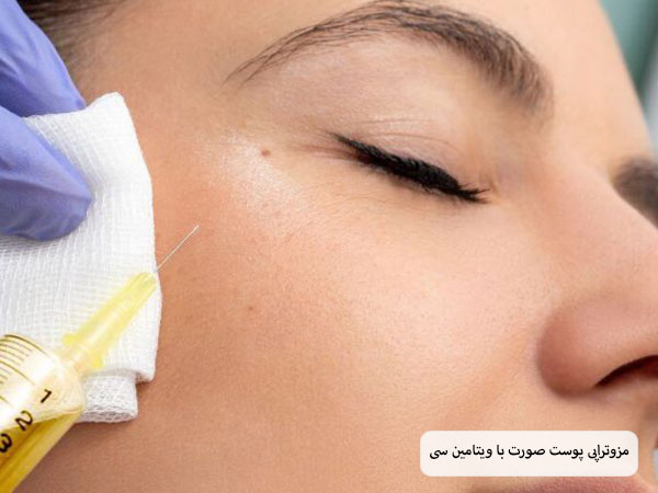 پزشکی در حال تزریق سرنگ حاوی مزو ویتامین سی به صورت یک زیبا جوی جوان.