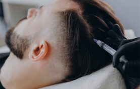 انجام مزوتراپی مو روی سر یک آقای جوان توسط پزشک.