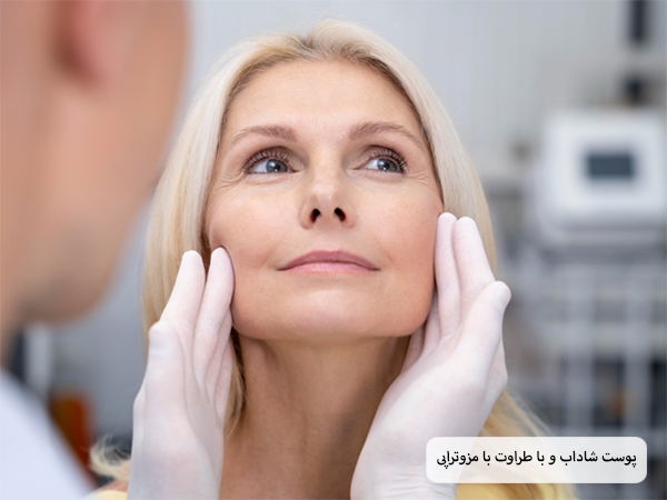 صورت یک خانم قبل و بعد از انجام مزوتراپی با هیالورونیک اسید.