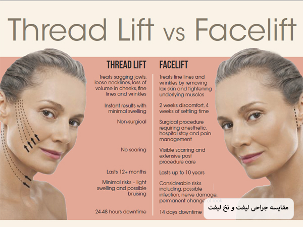 مقایسه عمل جراحی لیفت با نخ لیفت که در جدول شرح داده شده است.