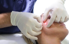 پزشکی در حال انجام عمل اندولیفت روی صورت یک خانم در محیط تخصصی.