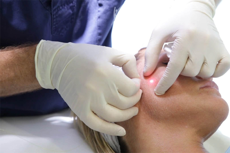 پزشکی در حال انجام عمل اندولیفت روی صورت یک خانم در محیط تخصصی.