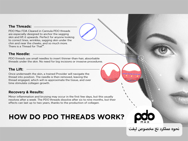 کاربرد و نحوه عملکرد نخ لیفت که در کنار صورت یک خانم نوشته شده با پس زمینه طوسی رنگ.