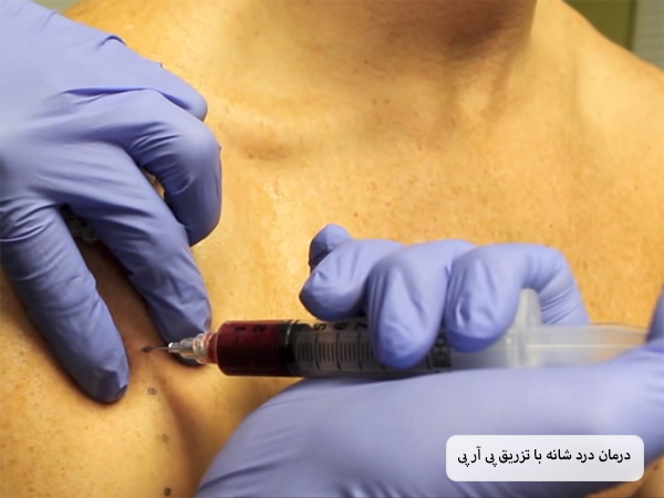 تزریق محلول پی آر پی به شانه های یک شخص توسط پزشک.