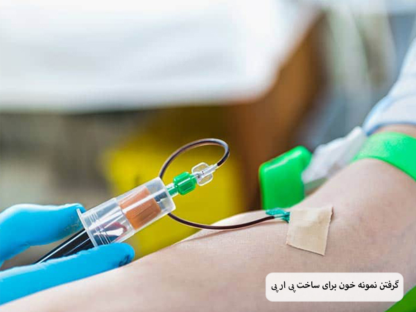 گرفتن خون از دست بیمار برای تهیه پی آر پی.