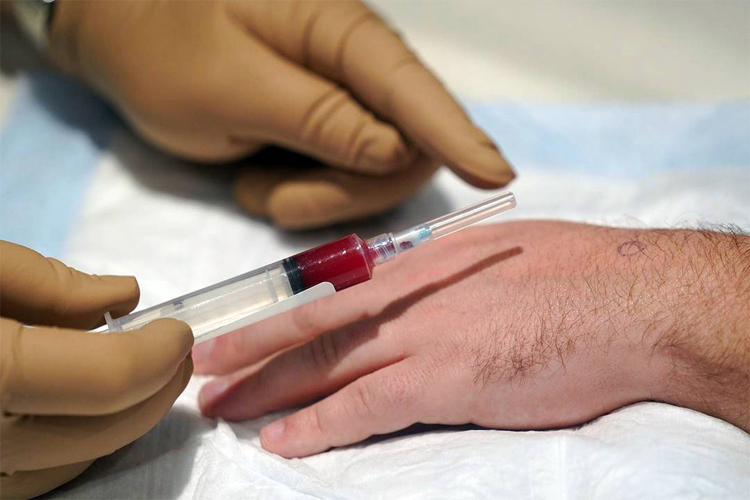 پی آر پی درمانی مچ دست یک آقا.