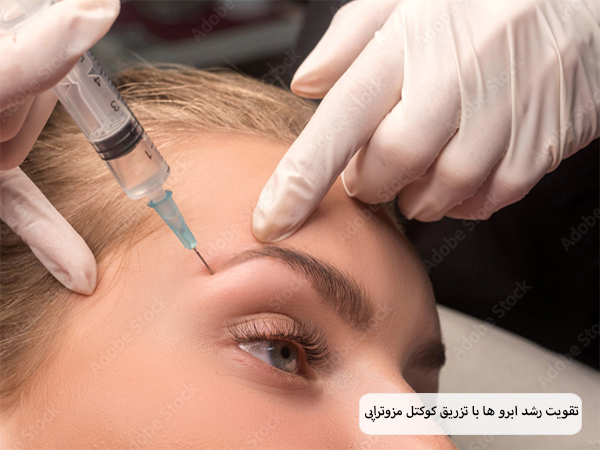 پزشکی در حال تزریق سرنگ حاوی کوکتل مزوتراپی به ابرو های یک خانم