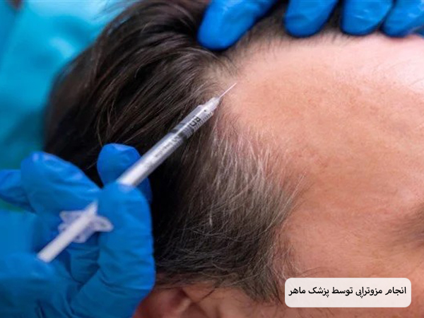 عکس سر یک آقا قبل و بعد از انجام مزوتراپی که رشد مو هایش افزایش چشم گیری داشته است.