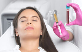 پی آر پی و نمونه خون بیمار که کنار صورتش قرار گرفته توسط پزشک.