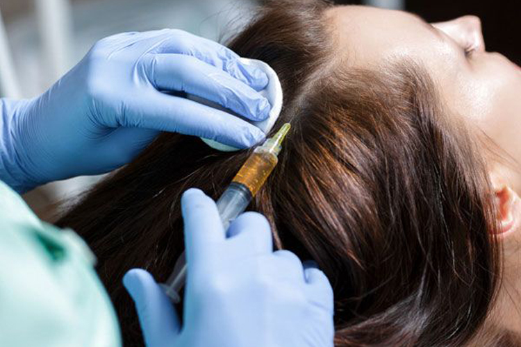 مزوتراپی موی سر یک خانم جوان توسط پزشک