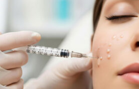 مزوتراپی صورت یک خانم جوان.