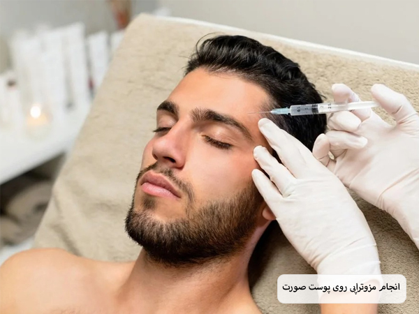 پزشکی در حال تزریق کوکتل مزوتراپی آبرسان به صورت یک مرد جوان است.