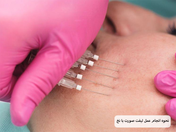 پزشکی در حال انجام عمل لیفت با نخ روی صورت یک خانم جوان است.