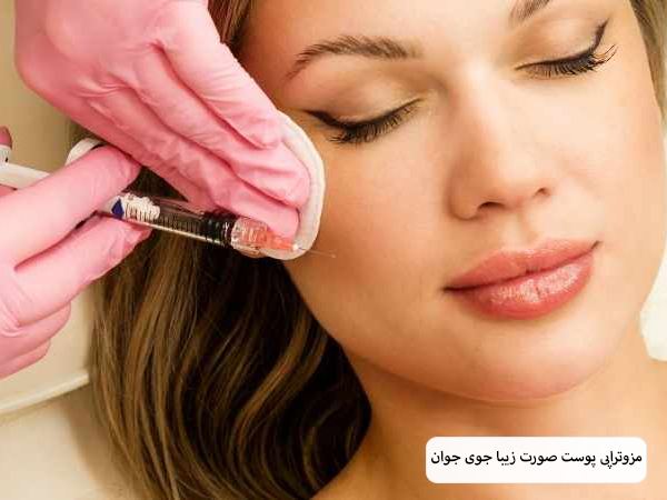تزریق کوکتل مزوتراپی به پوست صورت یک خانم.