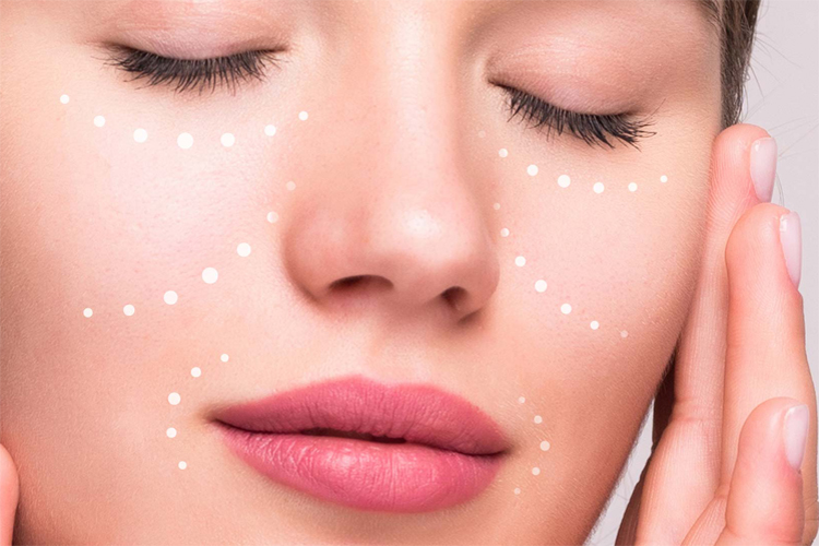 نقاط مختلف صورت مناسب برای مزوتراپی.